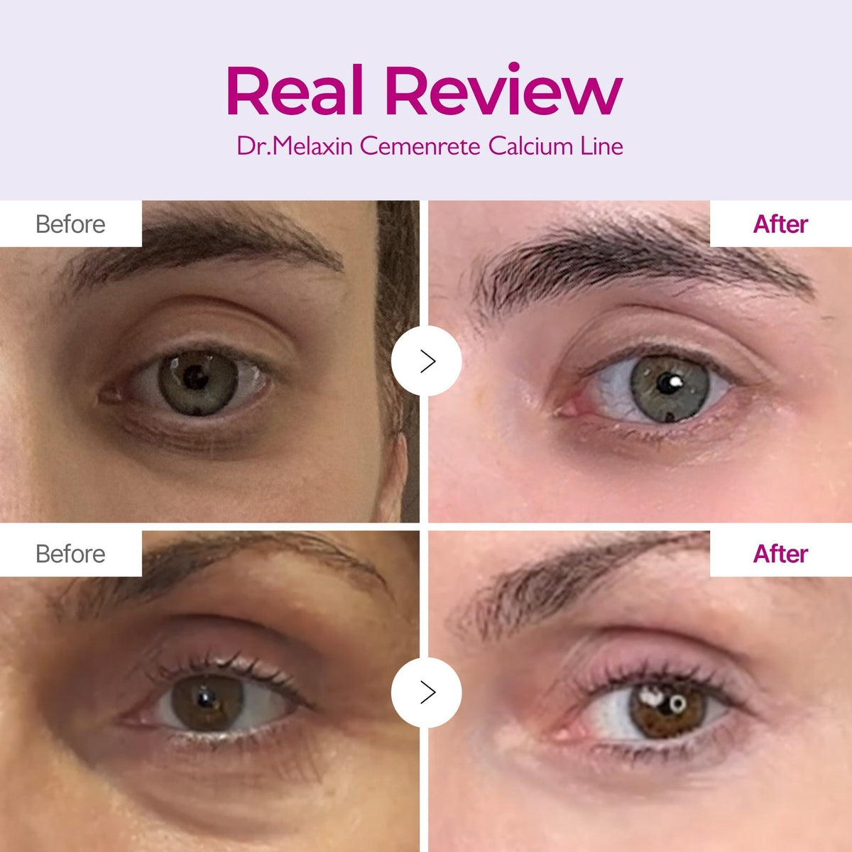 Dr Melaxin - Collagen Boost Set