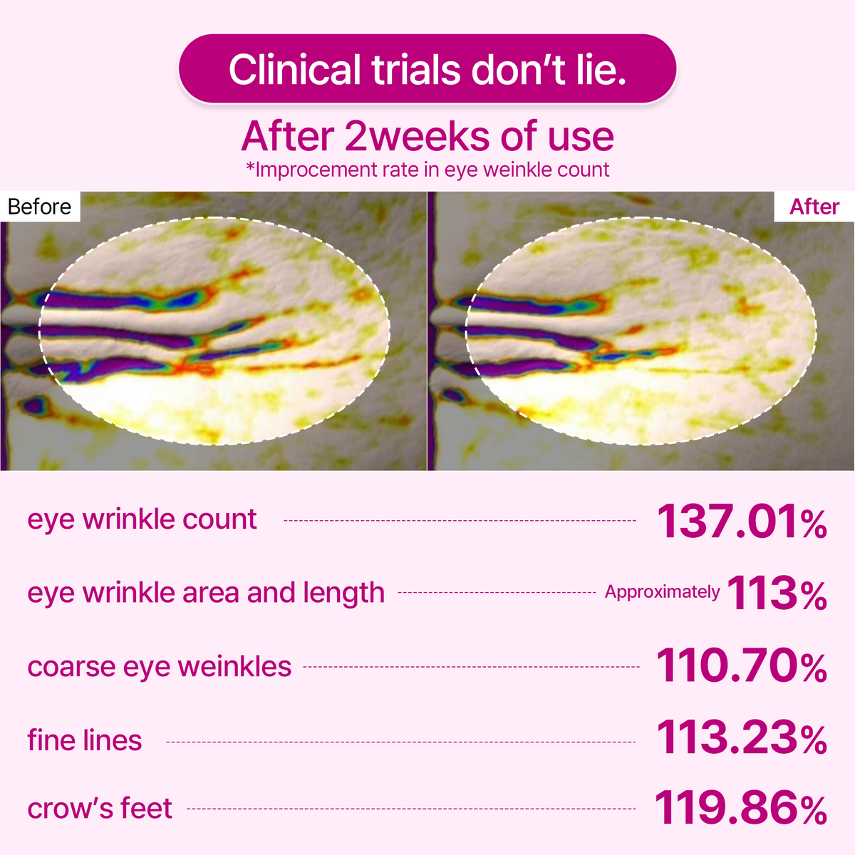 Cemenrete Calcium Volume Eye Patch